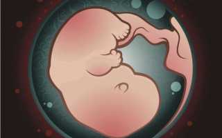 К чему приводят мутные воды при беременности?