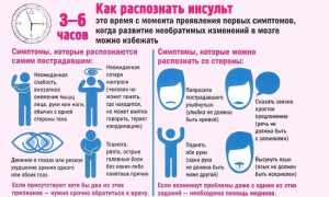 Причины и симптомы онемения языка