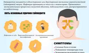 Антибиотик Цефтриаксон: инструкция по применению, цена, отзывы