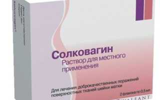 Химическая коагуляция эрозии шейки матки: суть процедуры, плюсы и минусы