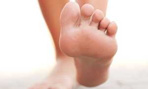 Как лечить грибок стопы в домашних условиях медикаментозными и народными средствами