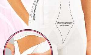 Правила выбора послеродового бандажа