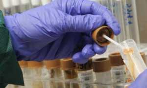 Диагностика хламидиоза у мужчин и женщин — осмотр у врача и лабораторные исследования