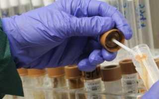 Диагностика хламидиоза у мужчин и женщин — осмотр у врача и лабораторные исследования