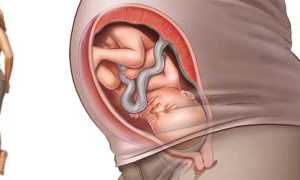 Почему беременным нельзя поднимать руки вверх