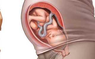 Почему беременным нельзя поднимать руки вверх