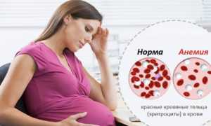 Гемоглобин при беременности (анемия): как повысить?