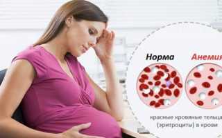 Гемоглобин при беременности (анемия): как повысить?