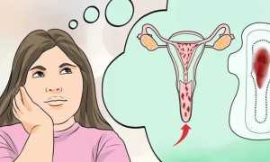 Месячные при приеме противозачаточных таблеток — как предупредить нарушение цикла и их причины