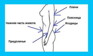 Дивигель при планировании беременности