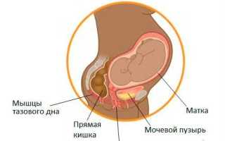 Почему кишечник давит на матку?