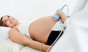 Второе УЗИ при беременности — сроки по плану и нормативные показатели обследования