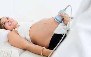 Второе УЗИ при беременности — сроки по плану и нормативные показатели обследования