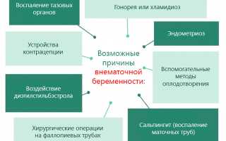 Какие бывают причины внематочной беременности?