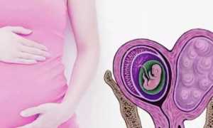 Миома матки при беременности