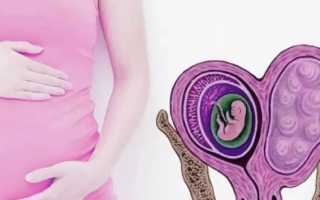 Миома матки при беременности