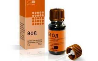 Йод против грибка ногтей — как избавиться от недуга