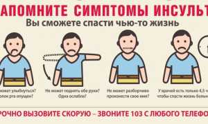 Виды инсульта — причины и симптомы заболевания, диагностика, способы лечения и профилактические меры