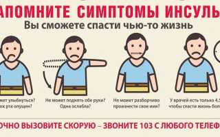 Виды инсульта — причины и симптомы заболевания, диагностика, способы лечения и профилактические меры