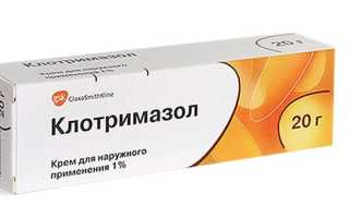 Чем лечить грибок ногтей на ногах