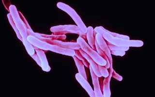 Возбудитель туберкулеза: виды бактерий и пути заражения