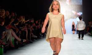 Гипофизарный нанизм – симптомы и признаки у детей и взрослых