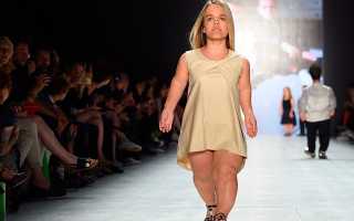 Гипофизарный нанизм – симптомы и признаки у детей и взрослых