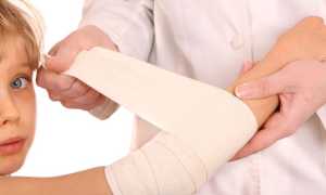 Ихтиоловая мазь