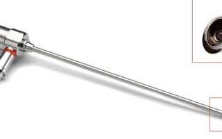 Как проводится лапароскопическая гистерэктомия миомы матки?