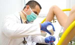 Что такое дрожжевой грибок и как его лечить