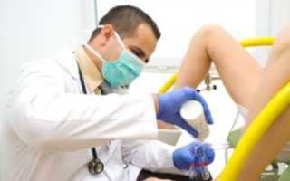 Что такое дрожжевой грибок и как его лечить