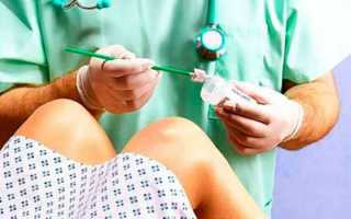 Необходимость взятия мазка при климаксе