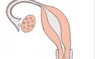 Однорогая матка и беременность: вероятность и возможные осложнения