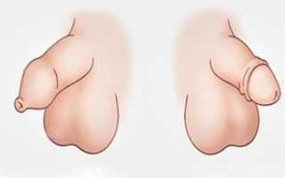 Половой орган мальчика детская урология