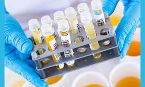 Важнейший ХГЧ в моче по дням от зачатия