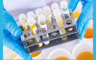 Важнейший ХГЧ в моче по дням от зачатия