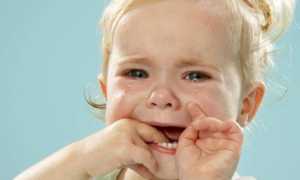 Признаки стоматита у детей и взрослых