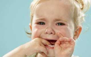 Признаки стоматита у детей и взрослых