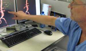 УЗИ брюшной аорты