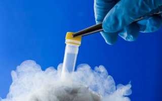 Криоконсервация яйцеклеток: как происходит?