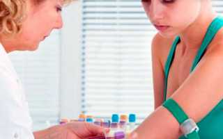 Что такое МФЯ (мультифолликулярные яичники)?