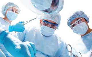 Ретрохориальная гематома — причины и симптомы заболевания, диагностика и проявления, методы лечения