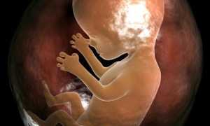 Бипариетальный размер головы