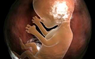 Бипариетальный размер головы