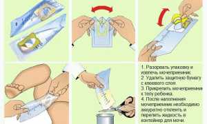Как правильно сдавать анализ мочи