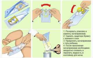 Как правильно сдавать анализ мочи