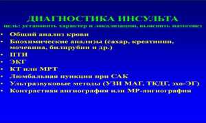Диагностика инсульта — первичная, аппаратные методики, анализы и дополнительные обследования