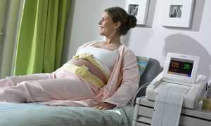 КТГ плода – что это?