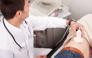 Частое мочеиспускание у мужчин