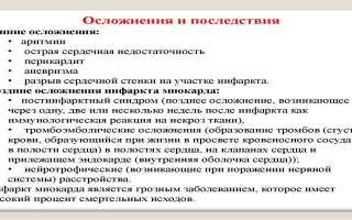 Симптомы инфаркта у женщин — специфические и неспецифические, предвестники и первая помощь